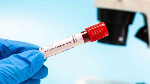 A blue-gloved hand holds an H. pylori antibody test blood sample in a test tube for microbiological research