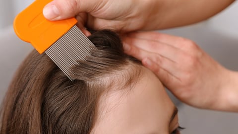 A parent using a nit comb on a child's head