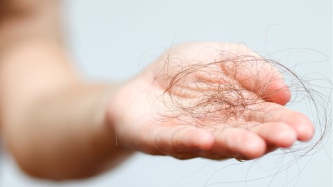 A fair-skinned hand holding a clump of brown hair