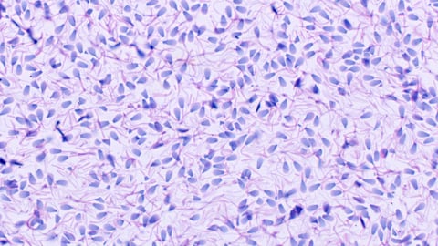 spermatozoa under a microscope
