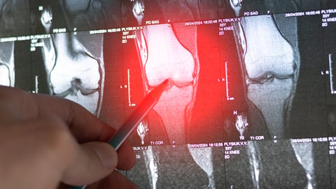 A knee x-ray with one image highlighted in red