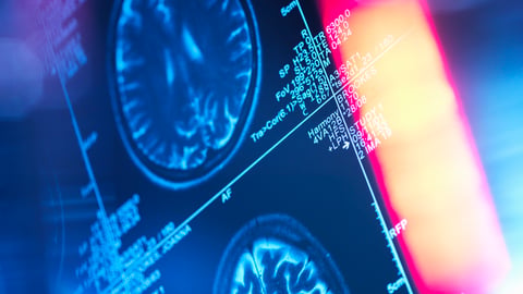 Close up of a brain scan with a red sun flare in the foreground