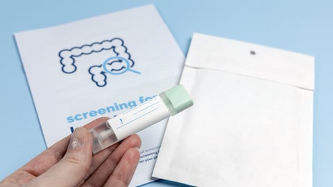 Rectal cancer screening test for home use and lab delivery.