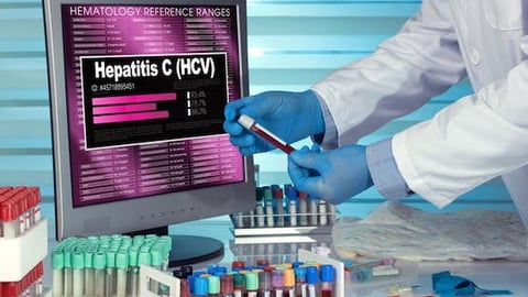 A researcher analyzing treatment for Hepatitis C.