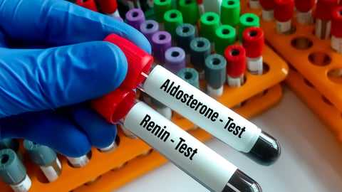 Gloved fingers holding test tubes labelled Aldosterone and renin