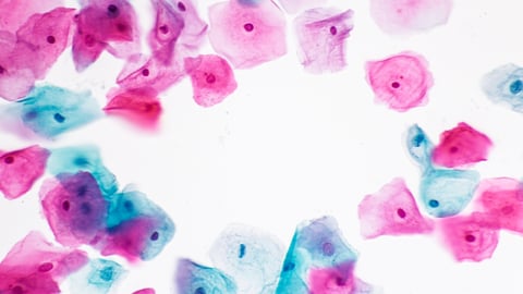 View in microscopic of normal human cervix cells