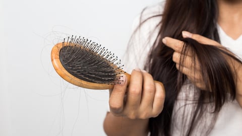 young woman worried about hair loss on a white background; Shutterstock ID 776715496