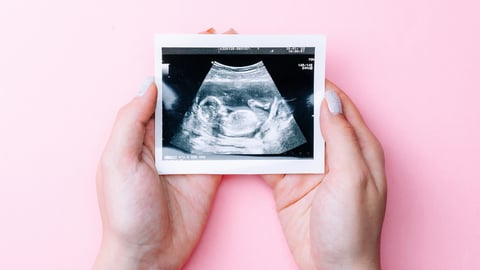 Hands holding a sonogram with a pink background