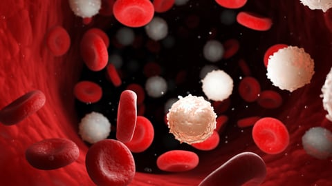 3-D rendering of leukemia in the bloodstream