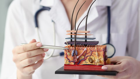 Dermatologist holds artificial model of human skin with hair. 