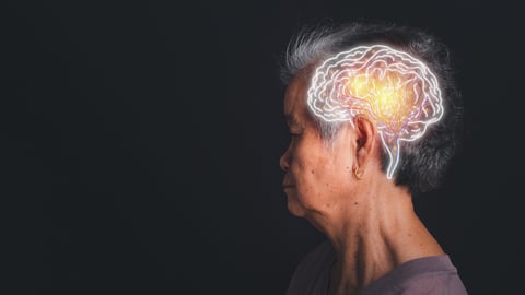 Profile of an older woman with a brain superimposed to represent neurological conditions