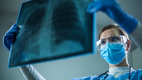 Female pulmonologist or oncologist holding chest X-ray scan,inspecting COVID-19 patient lungs,wearing PPE uniform,Coronavirus acute respiratory new virus disease infection causing breathing problems; Shutterstock ID 1741622102