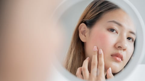 Woman worried about face Dermatology, rosacea dermatitis, allergic steroids, sensitive skin, red face from sunburn, acne, dry skin, large pores ,rash face, dull, freckles, wrinkle, skin problem; Shutterstock ID 2344897931