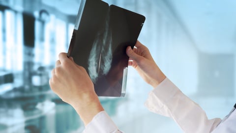 Doctor with Mammography; Shutterstock ID 292061510