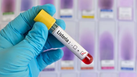 Blood sample tube positive with Listeria bacteria; Shutterstock ID 1041103306