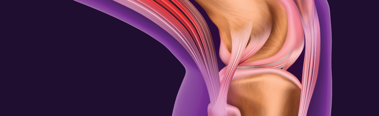 See through medical view of a knee and the inner muscles and bones of the leg