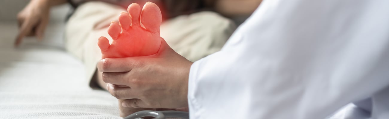 peripheral neuropathy in a patient's foot