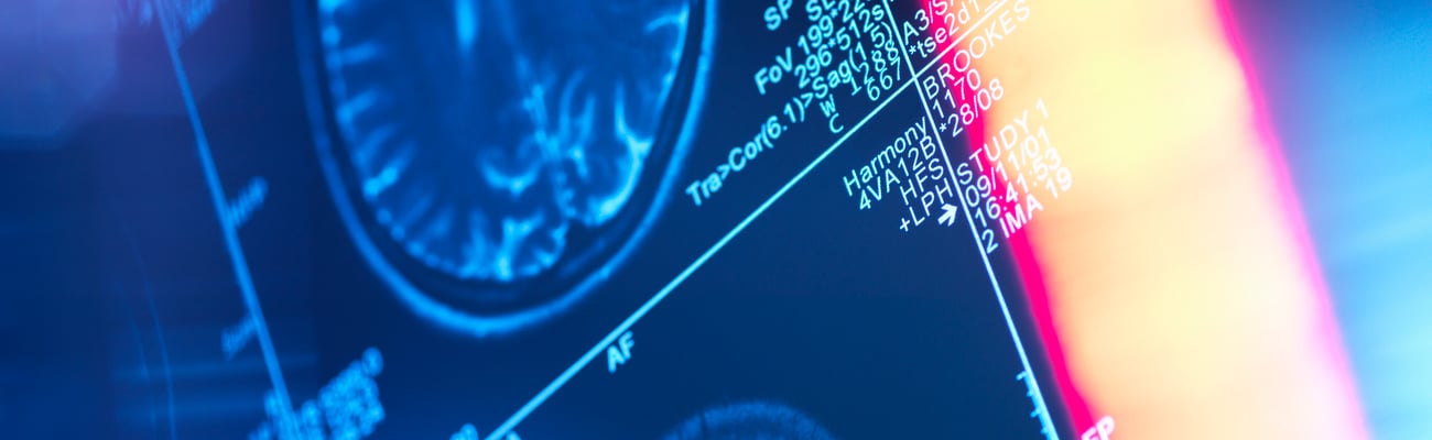 Close up of a brain scan with a red sun flare in the foreground