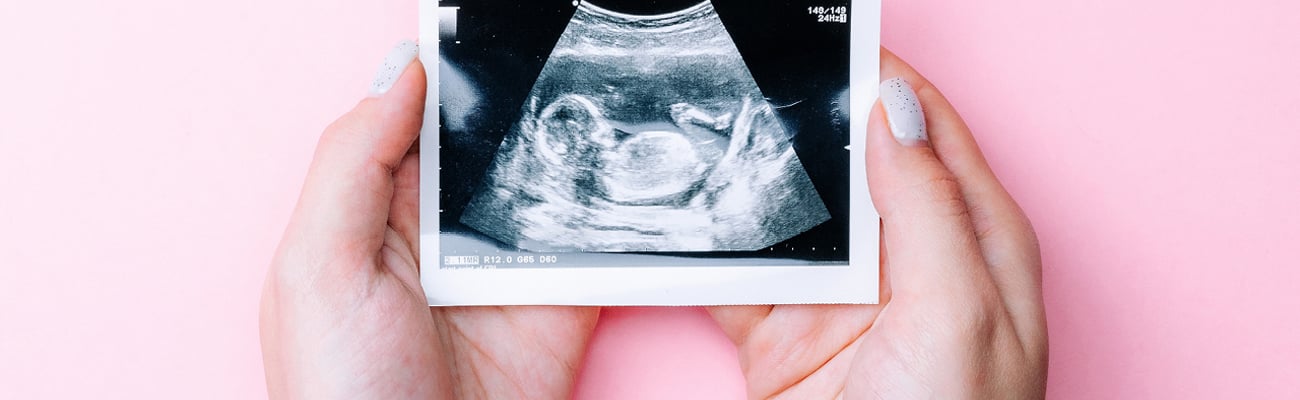 Hands holding a sonogram with a pink background