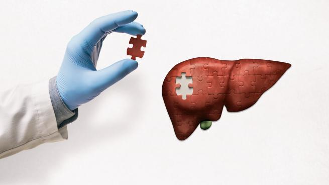 Physician with blue gloved hand placing last piece of a puzzle that is a picture of a human liver